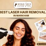Best Laser Hair Removal in Markham